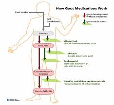 It is soluble in it, mainly in the form of urate and in small quantities as uric acid. Gout Risk Factors Diagnosis And Treatment