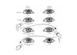 Normal Pupil Size For Perrla Perrla Eyes