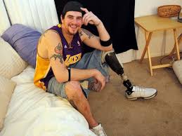 Maybe you would like to learn more about one of these? Matt Valdez Competes For Most Authentic Pirate Costume With Real Peg Leg