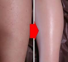 自宅で出来るコスパ最強の脱毛法 サロン通い不要の脱毛法が本当にすごい luckme 脱毛 自宅 美容 脱毛