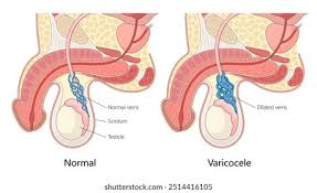 Image result for Scrotum