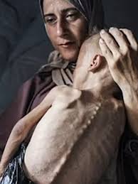 The Impact of Emaciation in Gaza
