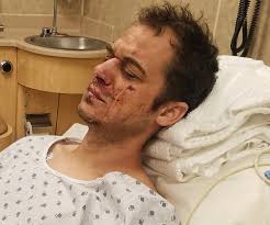 Its national traumatic brain injury (TBI) awareness week: I have suffered a  few concussion in my life some worse then others. I have worked really hard  to have clear speech and not