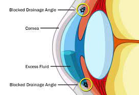 The journals or printed bills of the respective chambers should be consulted for official purposes. What Is Glaucoma Symptoms Treatment Definition