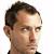 Receding Hairline Balding Haircuts