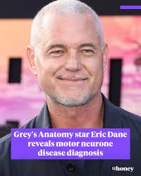 Eric Dane has announced he has been diagnosed motor neurone disease, hours  after his actress wife shared they were back together. Read more here ➡  https://nine.social/W9i