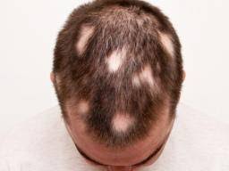 While you could shave your head without shortening the hair first, the process will become extremely messy and will take much, much longer to complete. The Benefits Of Shaving Your Head