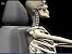 Animated Whiplash Injury Gif