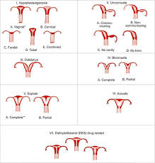 The cancer is in one or both ovaries. Jaypeedigital Ebook Reader
