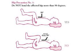Hip Precautions After Hip Surgery Learn To Prevent Dislocation Hip Precautions Hip Replacement Hip Replacement Exercises