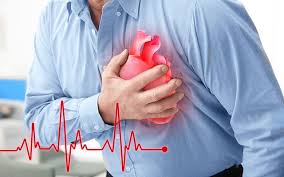Image result for Chest Pain