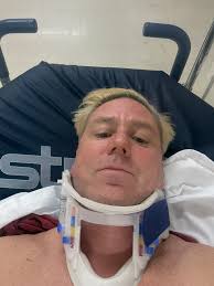 Guys I'm Sad to report that I took a street wipeout, Putting me out for  next 3 months