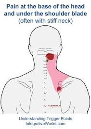 What i found out was that my occipital nerve was problems at the base of the skull or neck, are most always tension based. Pin On Fibromyalgia