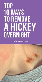 Love Tips For Kissing 5 Sensuous Kissing Tips Best Way To Make A Hickey Girl