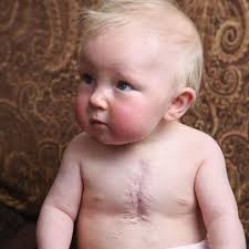 Tragic baby born with half a heart inspires brave mum to make heartbreaking  memory box