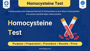 Image result for Homocysteine
