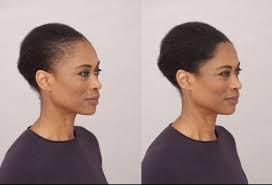When applying to the hairline, use free hand to cover the forehead to avoid product getting on the face. Knowing Your Hair Loss Concealer Options Toppik Blog