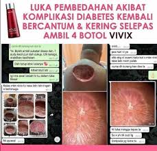 Berkat sifat yang antiinflamasi, ramuan daun bidara bisa membantu untuk mempercepat selain itu, daun dari tanaman bidara juga dapat menghilangkan bekas luka. Cara Merawat Luka Pengedar Shaklee Puchong 0193510266 Facebook