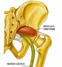 Maybe you would like to learn more about one of these? Que Es Una Falsa Ciatica O Ciatica Por Sindrome Del Piramidal