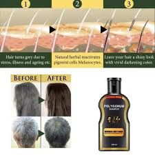 It needs to be used daily for the best results, but it's a great way to darken your hair without causing a lot of damage. 200ml Reverse Grey Hair Darkening Natural Polygonum Shampoo Shopee Philippines