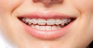 Try any or a combination of these remedies to relieve back pain. Orthodontics Maloccclusion Other Problems And Starting Treatment
