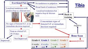 Image result for Fulcrum Test