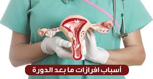 أسباب افرازات ما بعد الدورة ويب طب