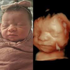 How Adorable is this sweet face??? We love comparison images.....show us  yours!!! :)