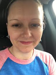 Dental implant recovery and soft foods