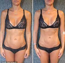 See more ideas about danielle lloyd, lloyd, fashion. Danielle Lloyd Reveals Results Of Her Nose Job Just 16 Days After Surgery In Turkey Oltnews