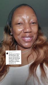 Replying to @lindagotay I an do glad this video found you in time. Dr.  Melaxin Peel Shots are awesome when used correctly! So good!  #Exfoliation101 #drmelaxin