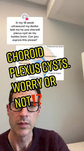 Bilateral Choroid Plexus Cysts Ultrasound