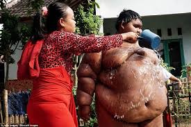 We did not find results for: Arya Permana From Indonesia Is The World S Fattest Boy Nairaland General Nigeria