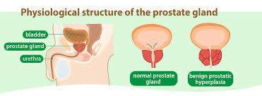 Image result for Expressed Prostatic Secretion