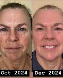 Woo hoo!!! Thirty years and counting!💍