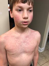 Any help for my dog's skin rash?