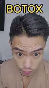 Botox 💉 #botoxchallenge #botoxmagic #botoxface #botoxinjection #skinc...
