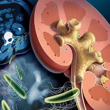 Mozhno Li Gret Pochki Kogda Oni Bolyat Polza I Vred Progrevanij Gbuz Bryanskaya Mezhrajonnaya Bolnica