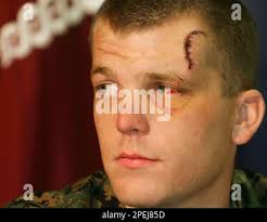 U.S. Marines Lance Cpl. Ryan Chapman, from Harlan, Kentucky, a machine  gunner of the 1st Battalion 3rd Marine Regiment, listens to a question  during a news conference at the Regional Medical Center