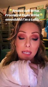 Skating Broken Wrist