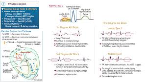 Pin On Cardiology