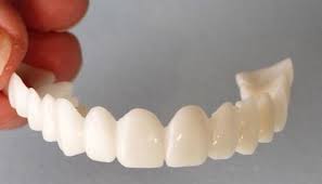 Using a temporary flipper tooth will help stabilize your teeth, keeping them from shifting while you wait for your permanent replacement. From Flippers To Grillz Celebrity Dental Tricks