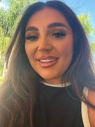 My new smile ! Even with the swelling they look beautiful!