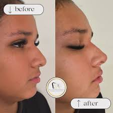 Dra. Esmeralda Carpenter (@dr.esme.ivardent) • Instagram photos and videos