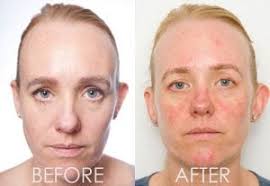 WHY YOU SHOULD STOP SLEEPING WITH MAKEUP ON