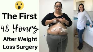 Pin On Gastric Sleeve Surgery Vsg Surgery