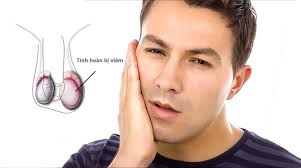 Viêm tinh hoàn do quai bị: Dấu hiệu và cách điều trị