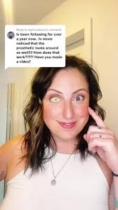 Reply to @taylorclaburn she’s a dancing queen 💁🏻‍♀️ #fakeeye #oneeyegang  #dancingqueen