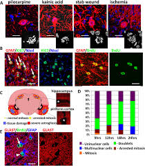 Cancer and mitosis are closely related. Abnormal Mitosis In Reactive Astrocytes Acta Neuropathologica Communications Full Text