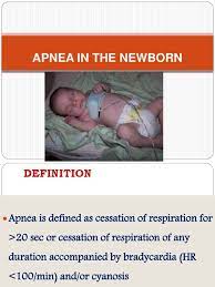 Review of patient records and careful examination of the brain following autopsy. Apnea In The Newborn Apnea Respiratory Tract